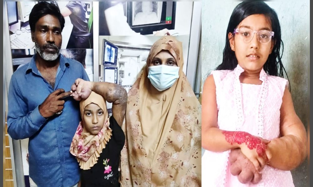স্কুলে যাওয়ার বয়সে ঘরবন্দি জিদনী, বিরল রোগে ফুলে গেছে হাত