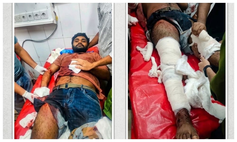জমি বিরোধের জেরে মাদারীপুরে যুবককে কুপিয়ে জখম
