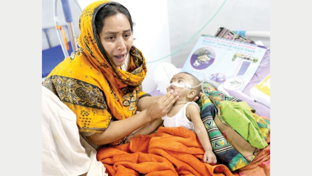 হাম উপসর্গে আরও ৩ জনের মৃত্যু